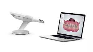 Scanner for Crowns